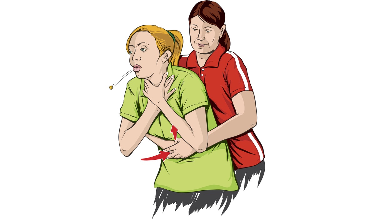 Heimlich maneuver - Il Mondo delle Donne