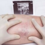 A doctor in gloves examines the veins and legs of the patient for the presence of thrombosis and varicose veins of the extremities, close-up, white background, ultrasound shot, medical