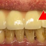 copertina sbiancare i denti